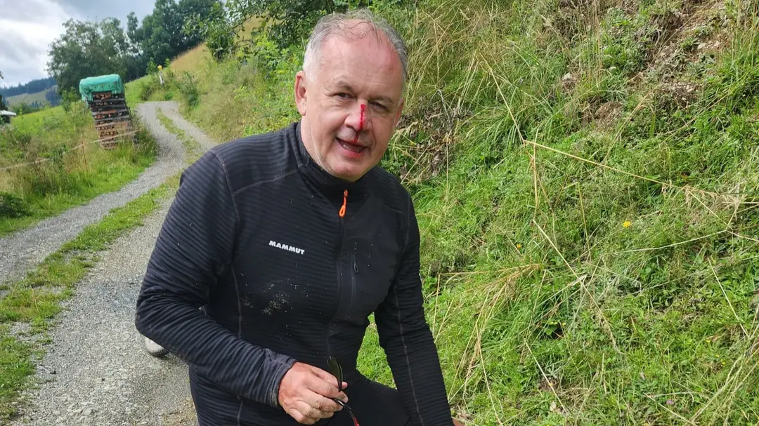 Andrej Kiska mal nehodu na bicykli.