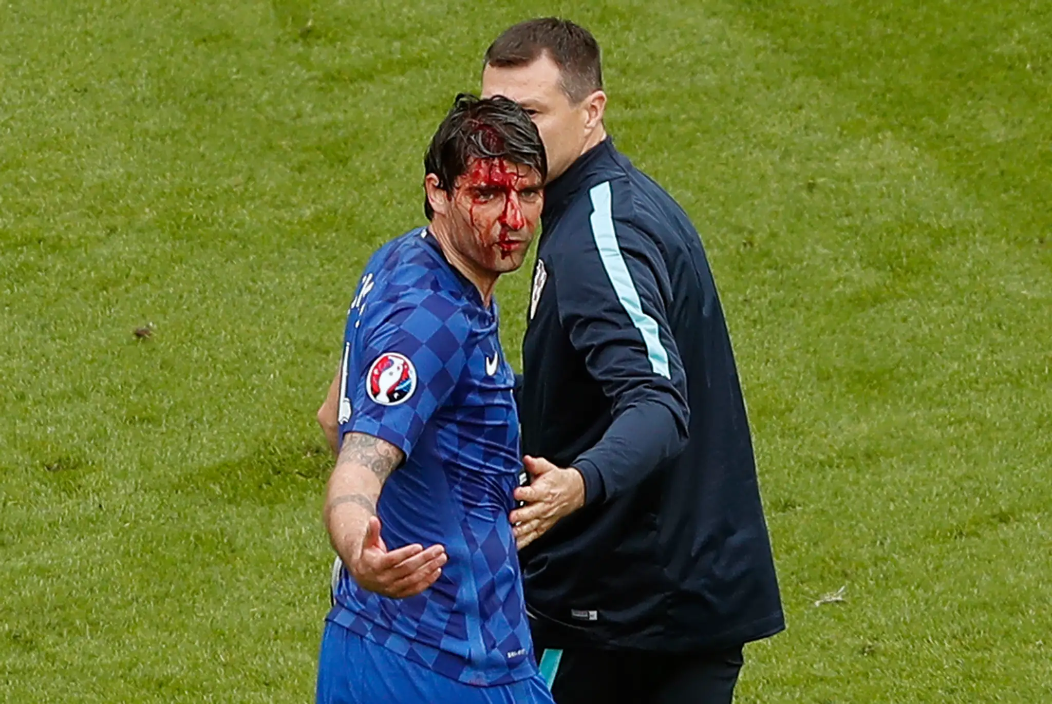 Zakrvavený Vedran Čorluka v zápase s Tureckom.