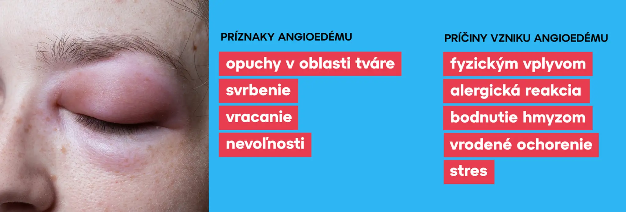 Tomáš je v šoku.