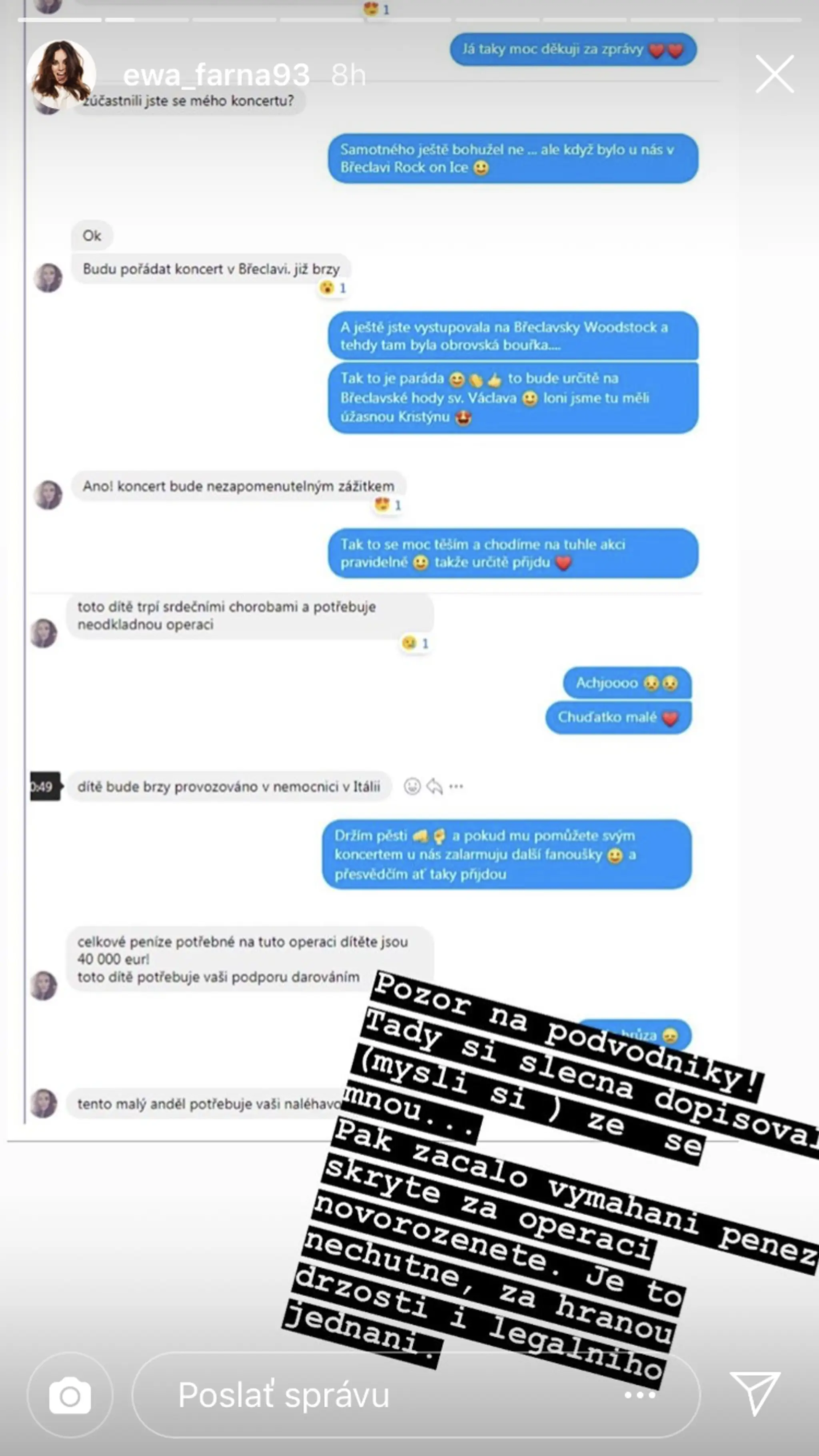 Žena uviazla zaseknutá v eskalátore, museli jej amputovať ľavú nohu.