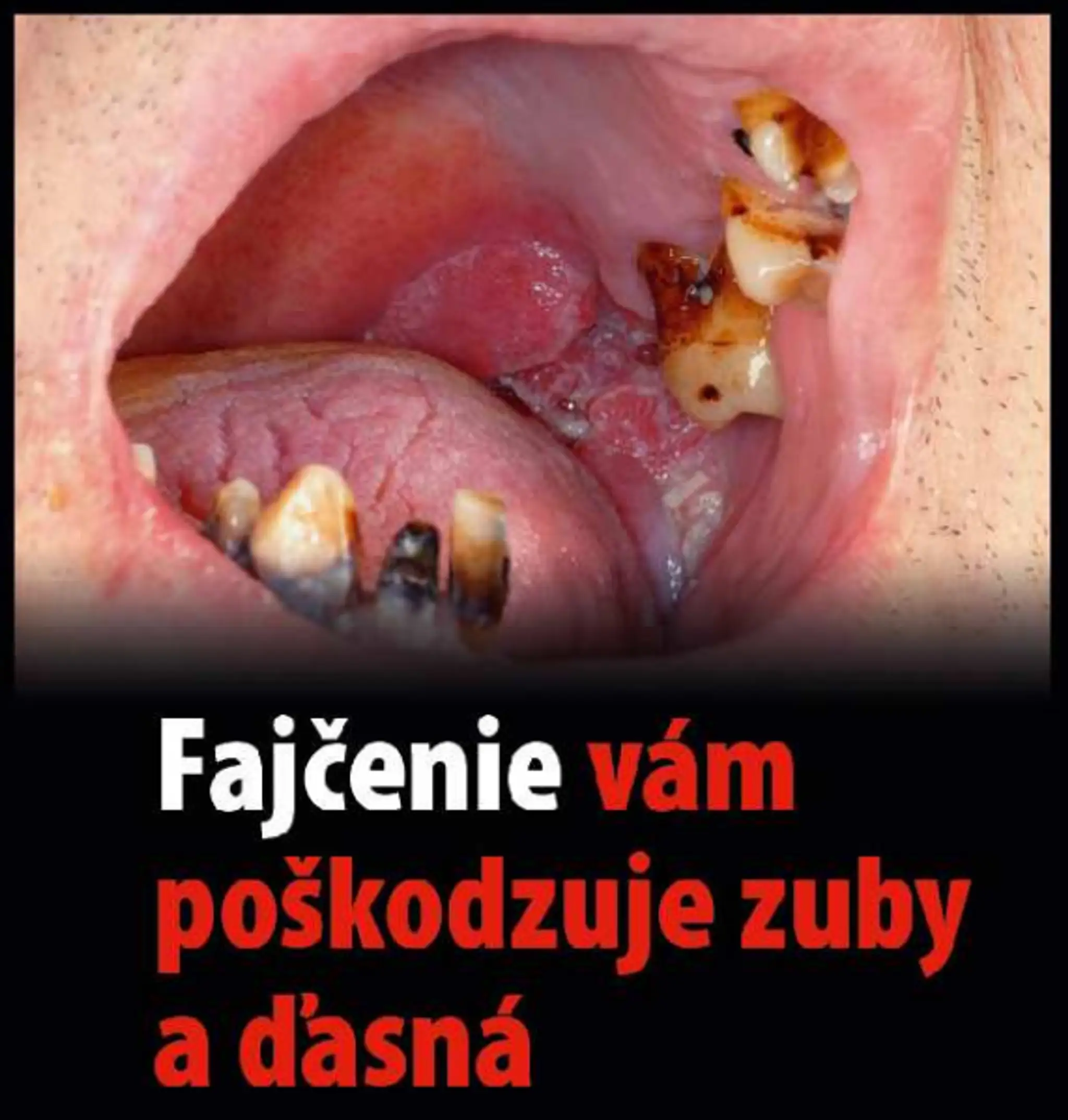 Varovanie, čo všetko môže spôsobiť fajčenie
