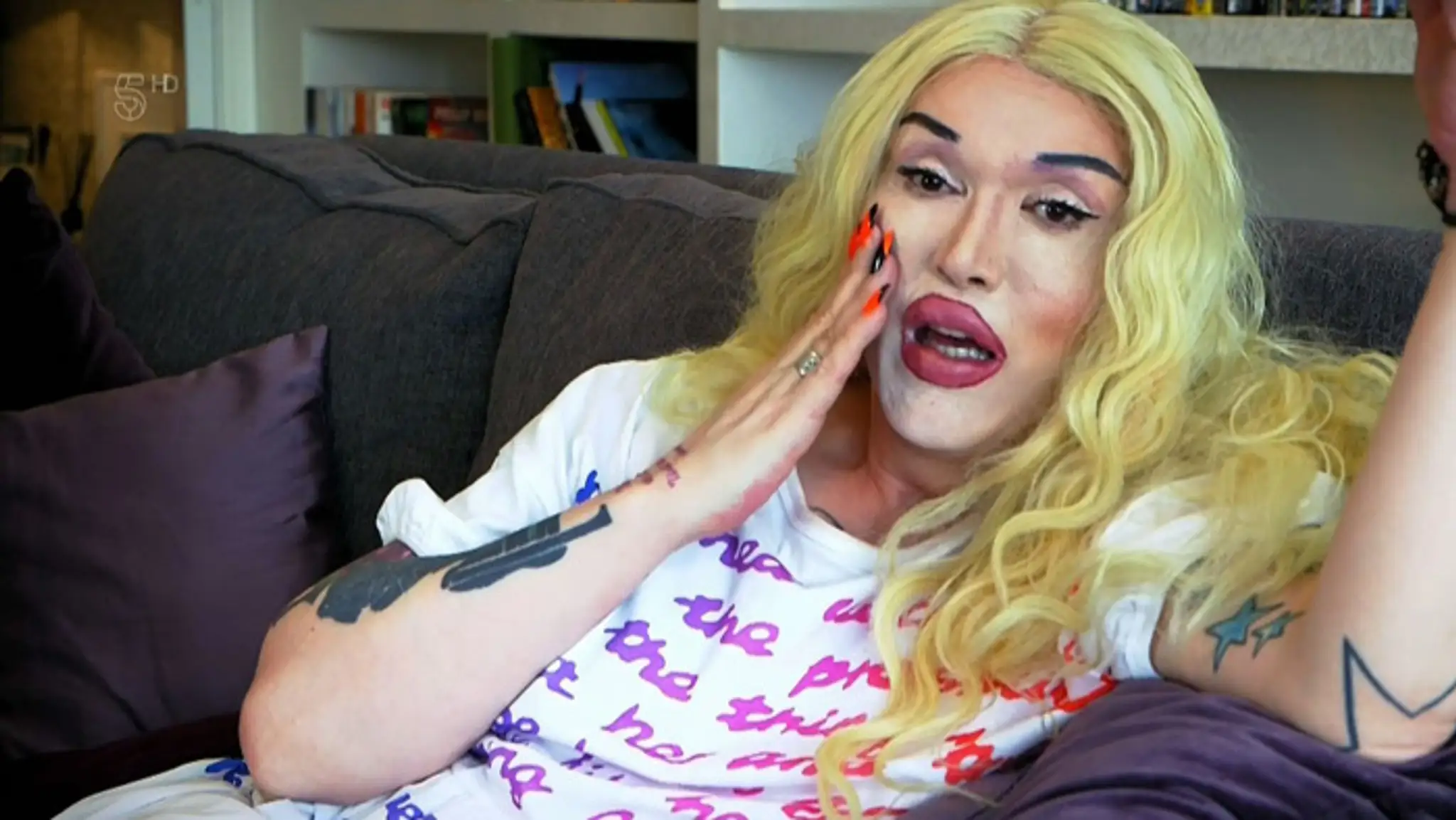 Pete Burns v TV šou "Celebrity Botched Up Bodies".