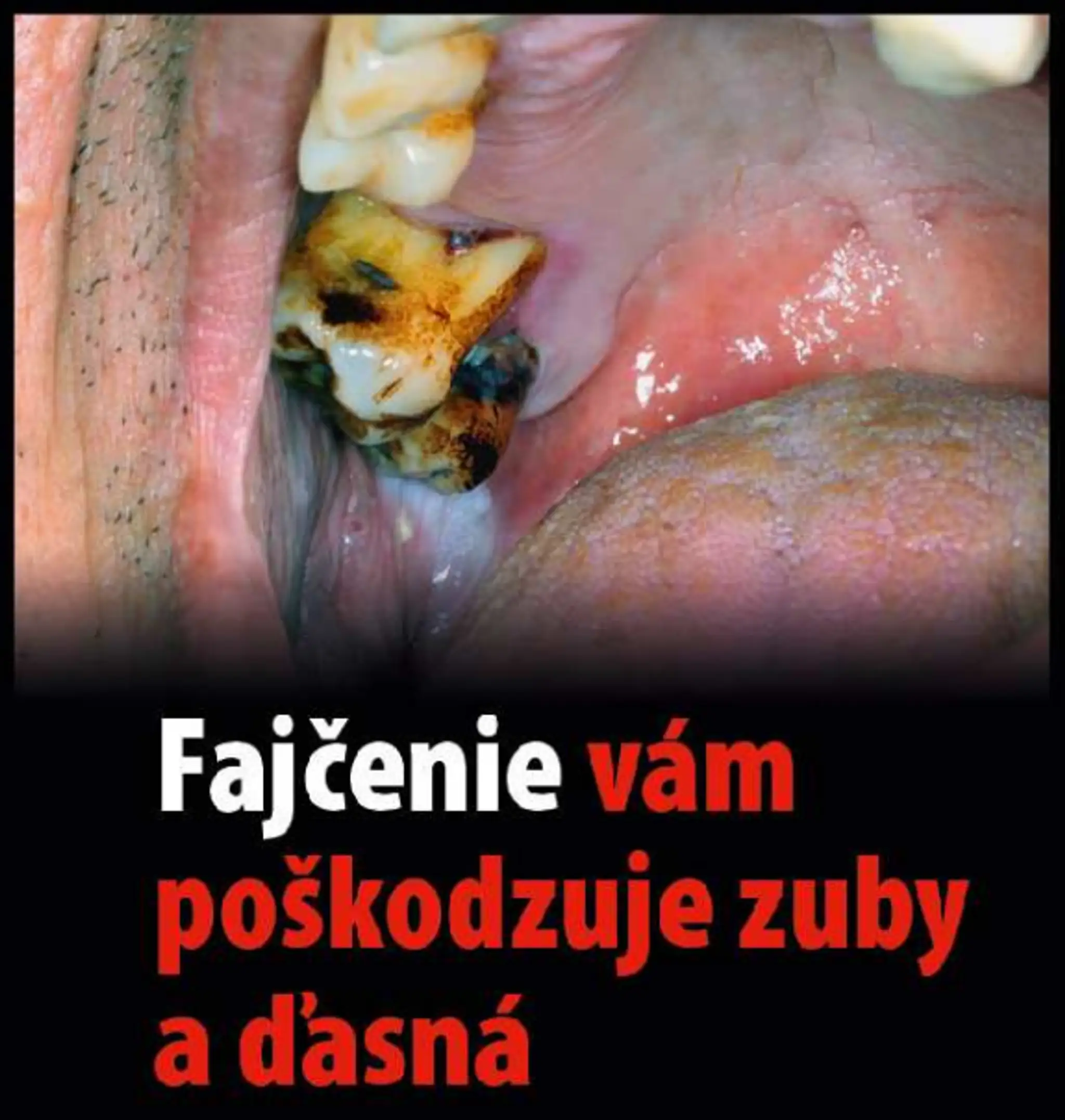 Varovanie, čo všetko môže spôsobiť fajčenie