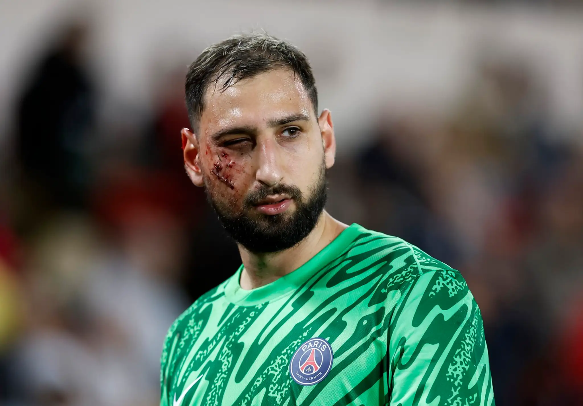 Gianluigi Donnarumma utrpel nepríjemné zranenie.