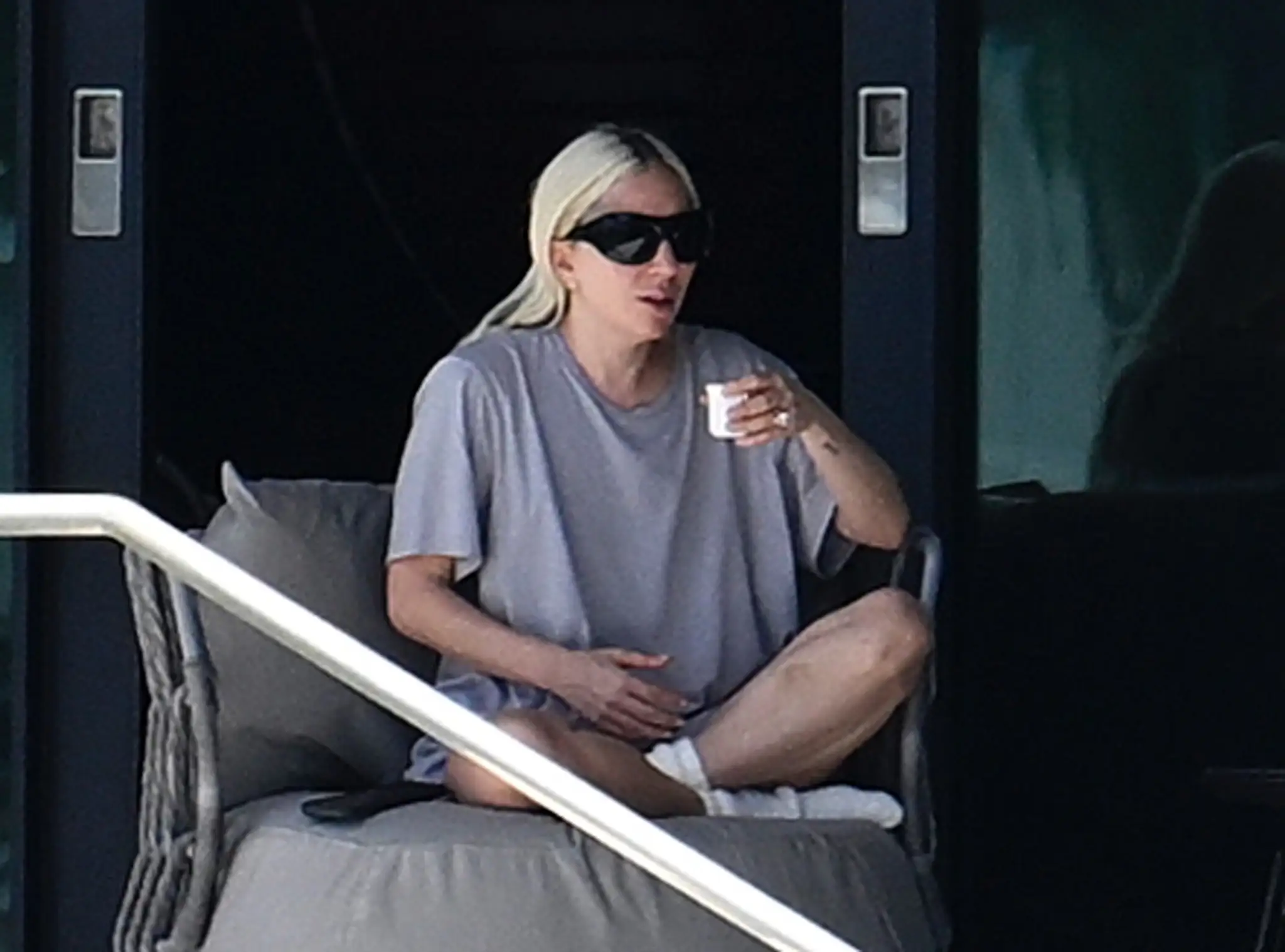 Lady Gaga bola hospitalizovaná na psychiatrii