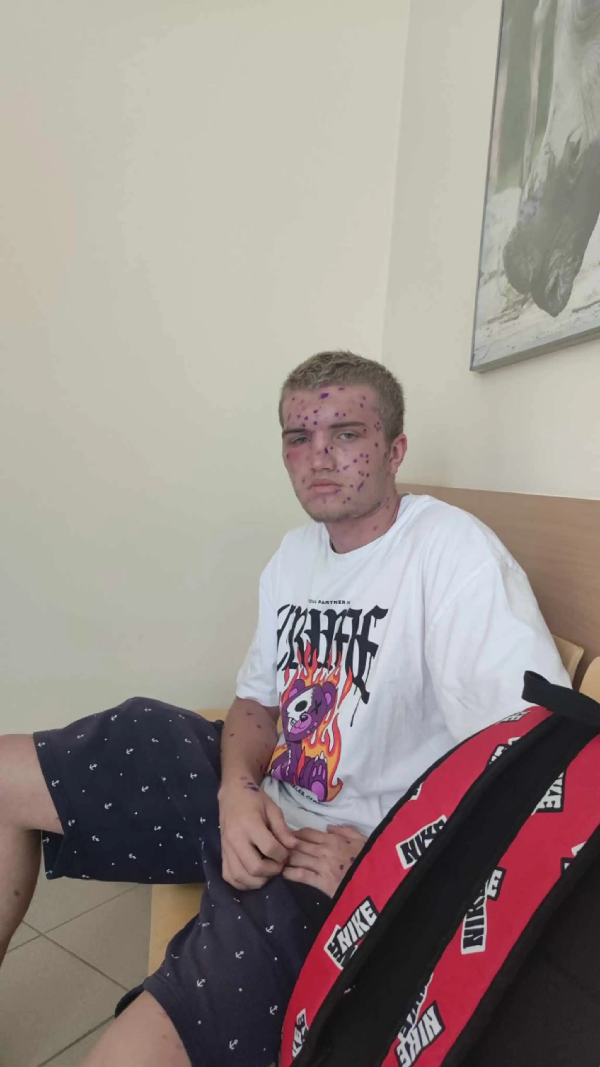Kiahne mu zobrali nohy