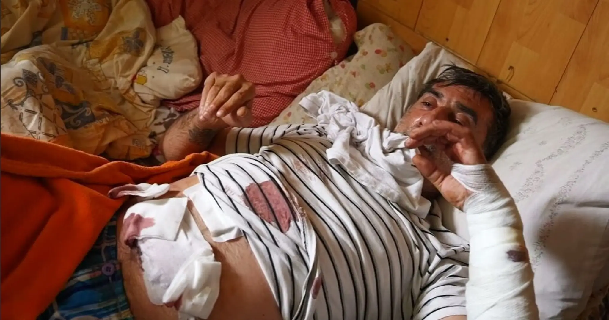 Po napadnutí medveďom