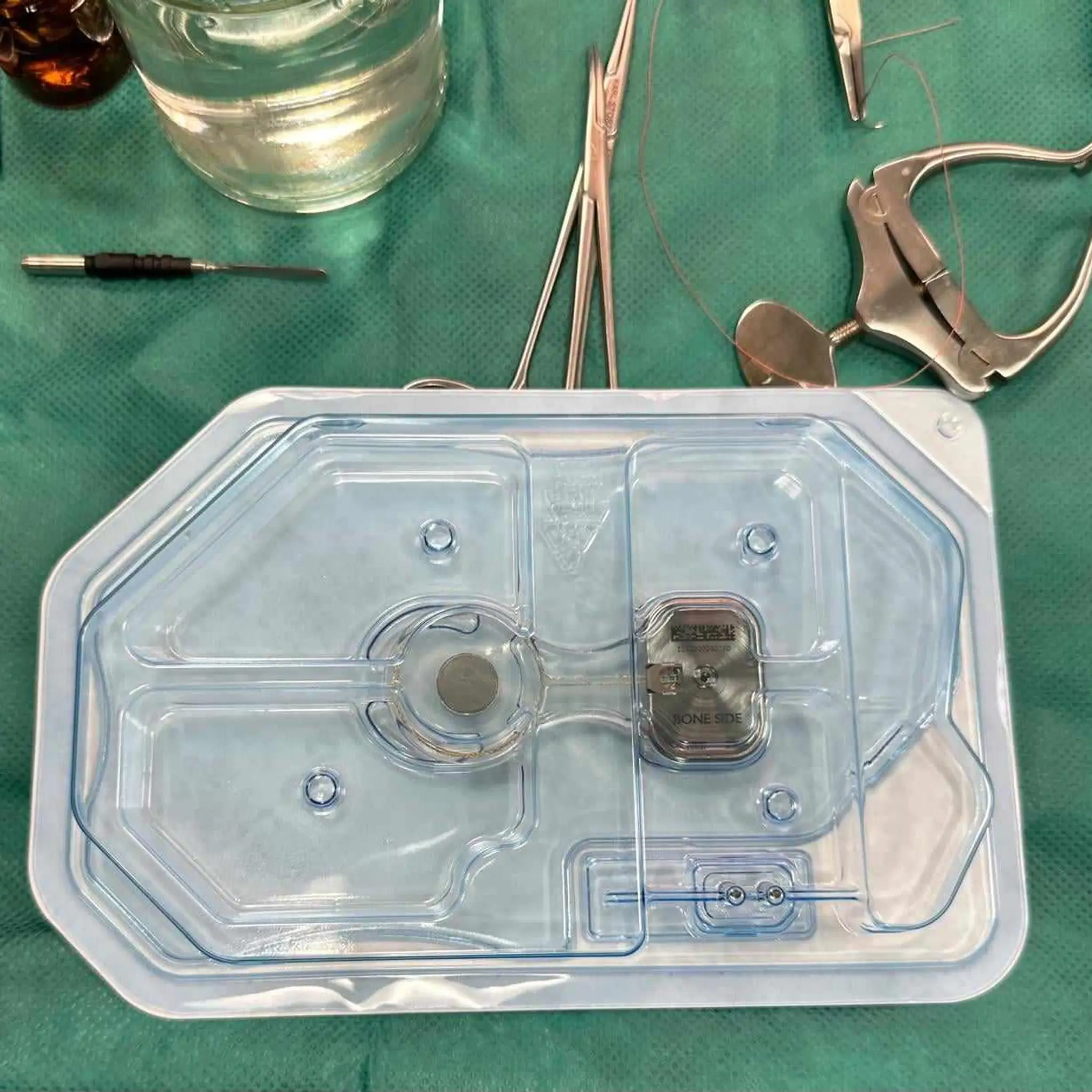 Lekári z Detskej fakultnej nemocnice Košice prvýkrát zaviedli unikátny sluchový implantát