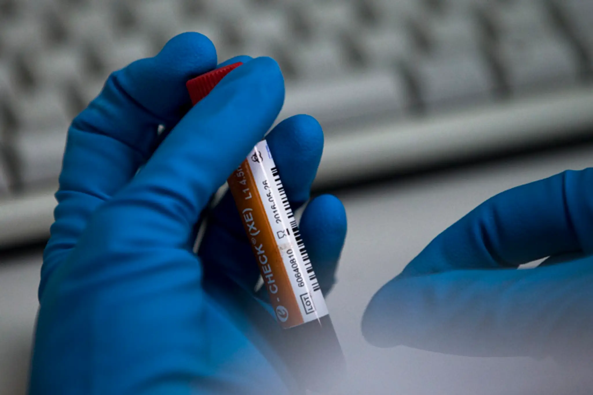 Na archívnej snímke zamestnanec ruského laboratória na doping drží vzorku krvi. (ilustračné foto)