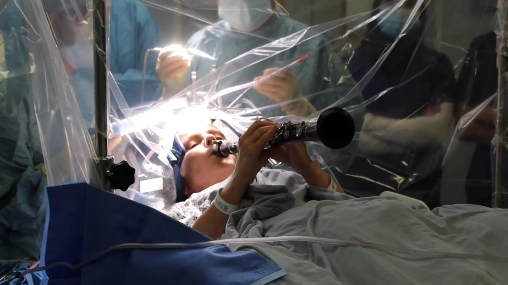 Žena počas operácie hrala na klarinete priamo v sále