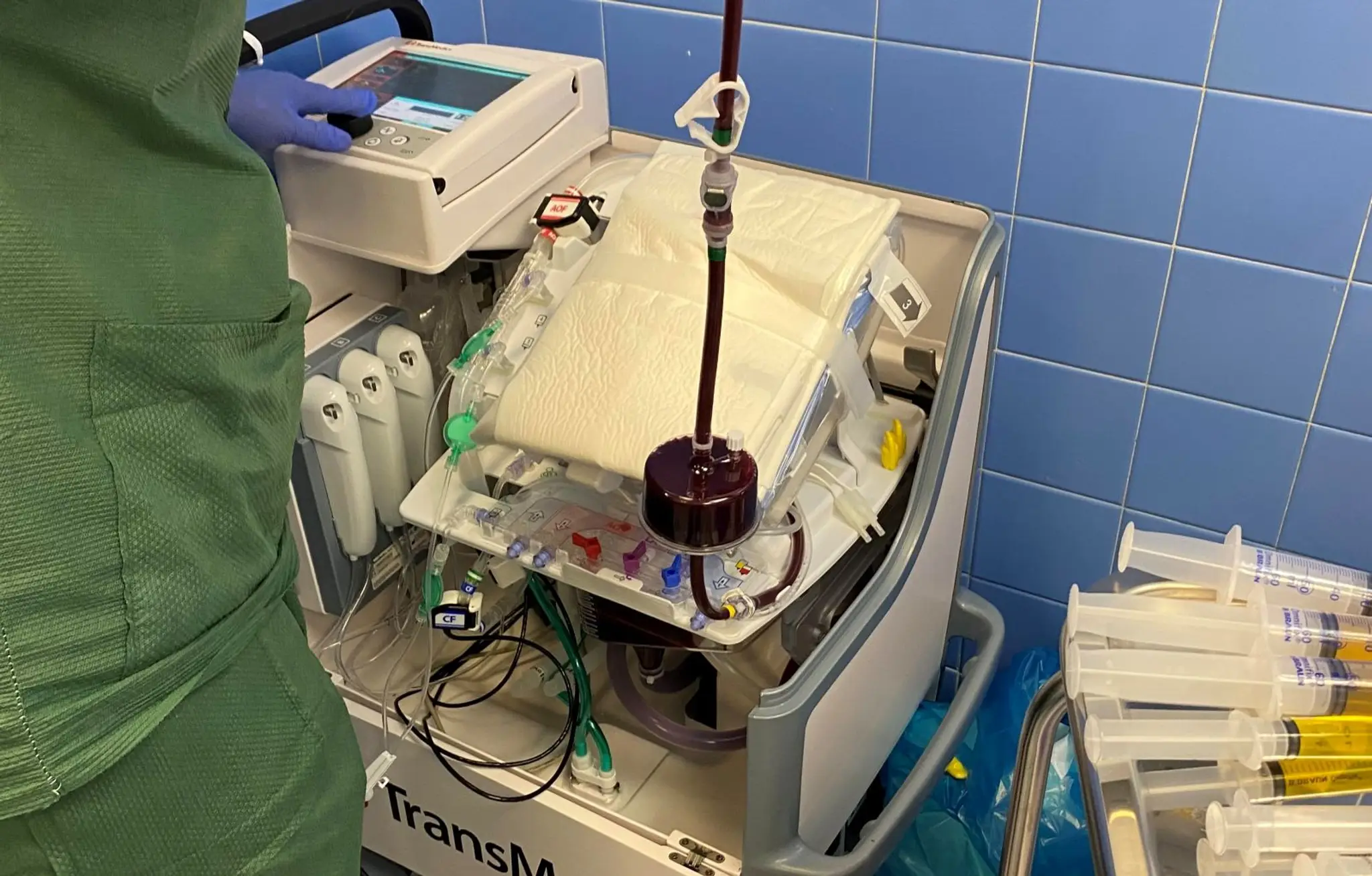 Transplantácia bijúceho srdca.