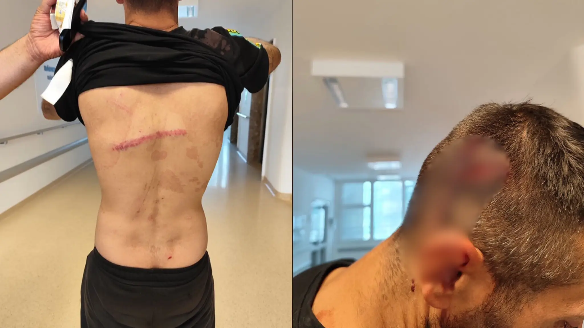 Zadržaného muža mal zmlátiť policajt