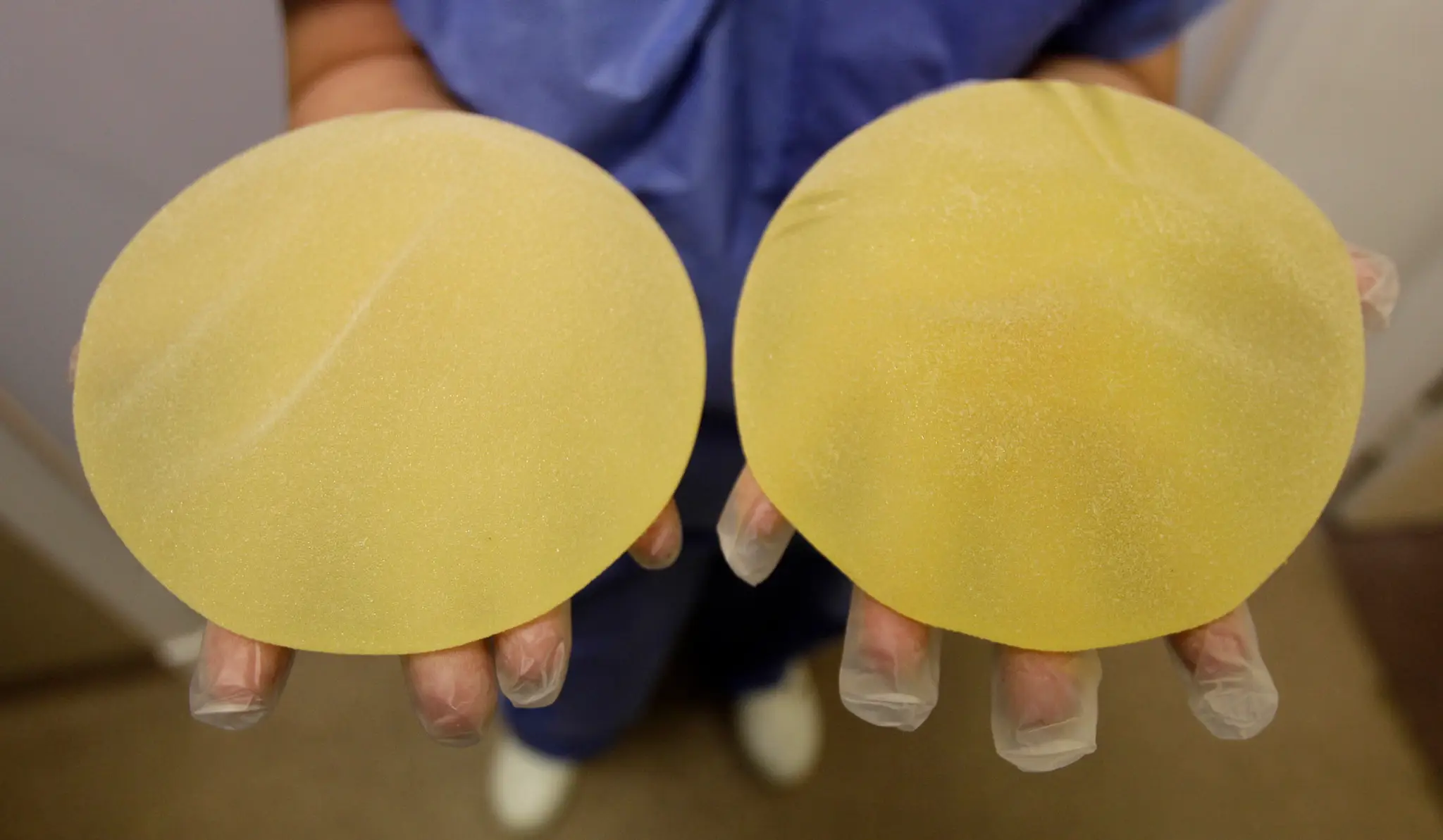Zdravotná sestra drží chybné prsné implantáty vyrobené francúzskou spoločnosťou Poly Implant Prothese.