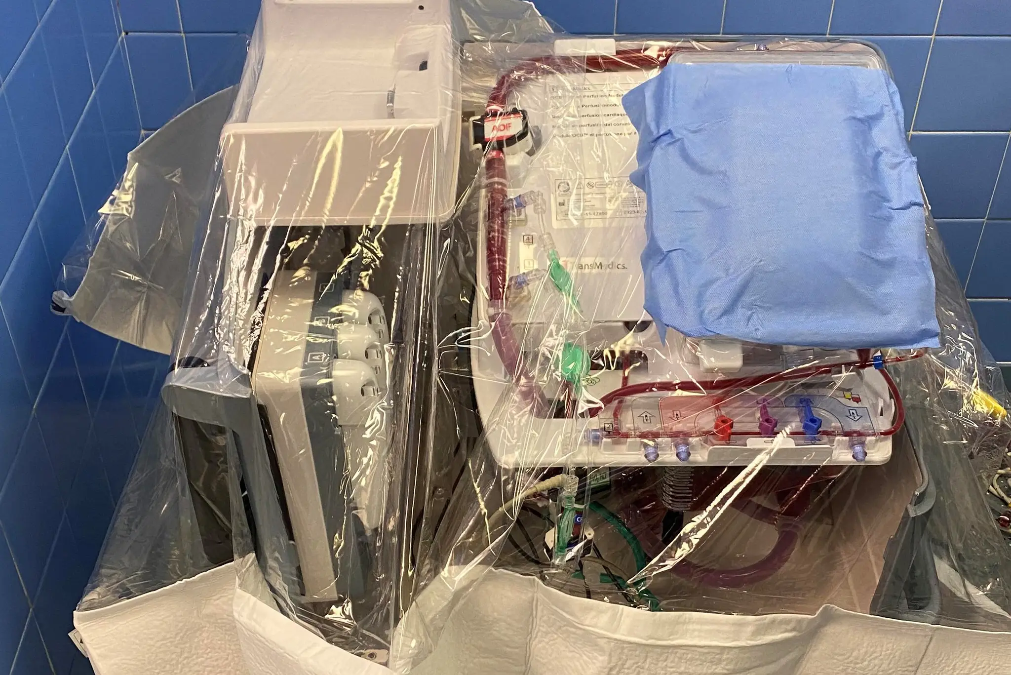 Transplantácia bijúceho srdca.