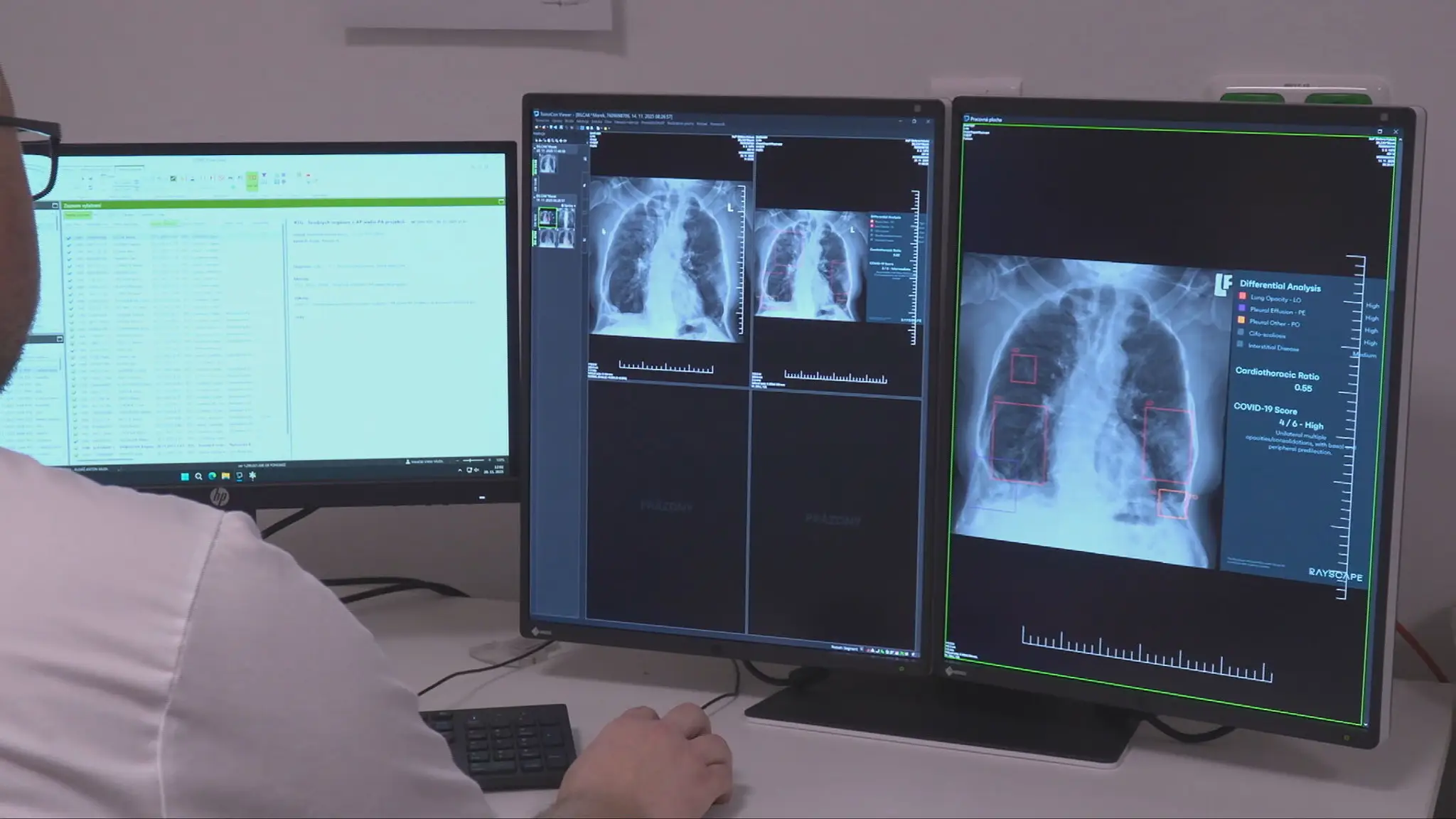 AI pomáha v zdravotníctve