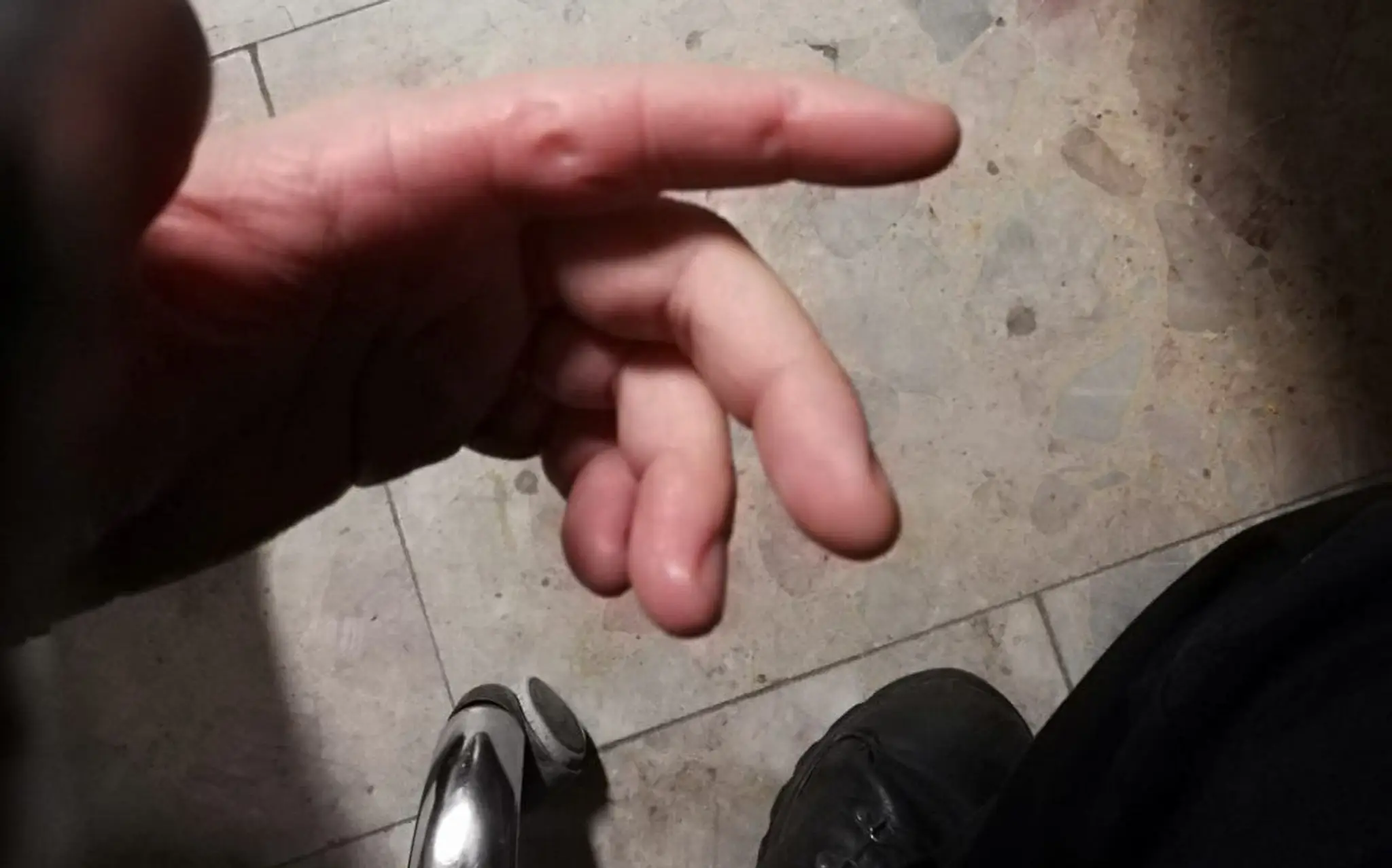Uhryznutá ruka policajta.