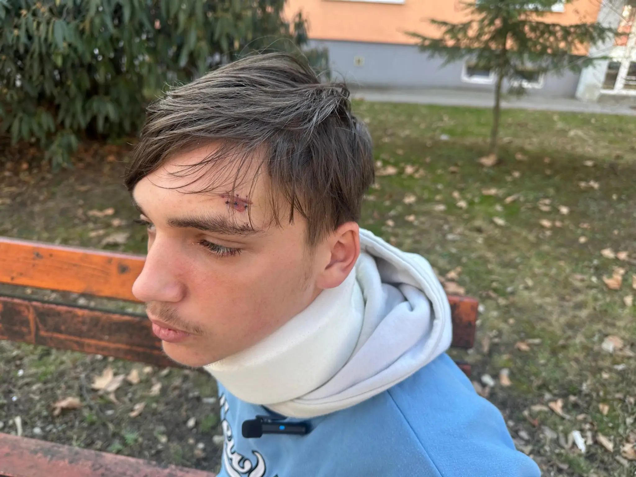 Tomáš, ktorý sa stal obeťou brutálneho útoku teleskopickou tyčou.