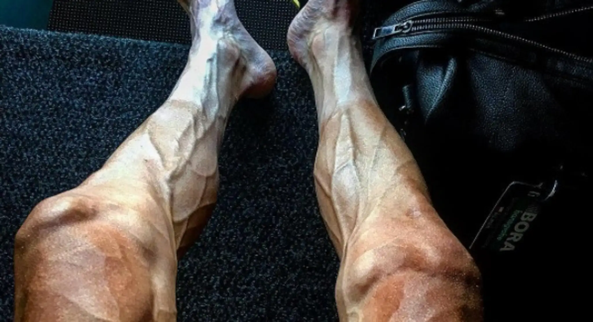 Nohy Pavla Poljanskeho po 16. etape Tour de France 2017.