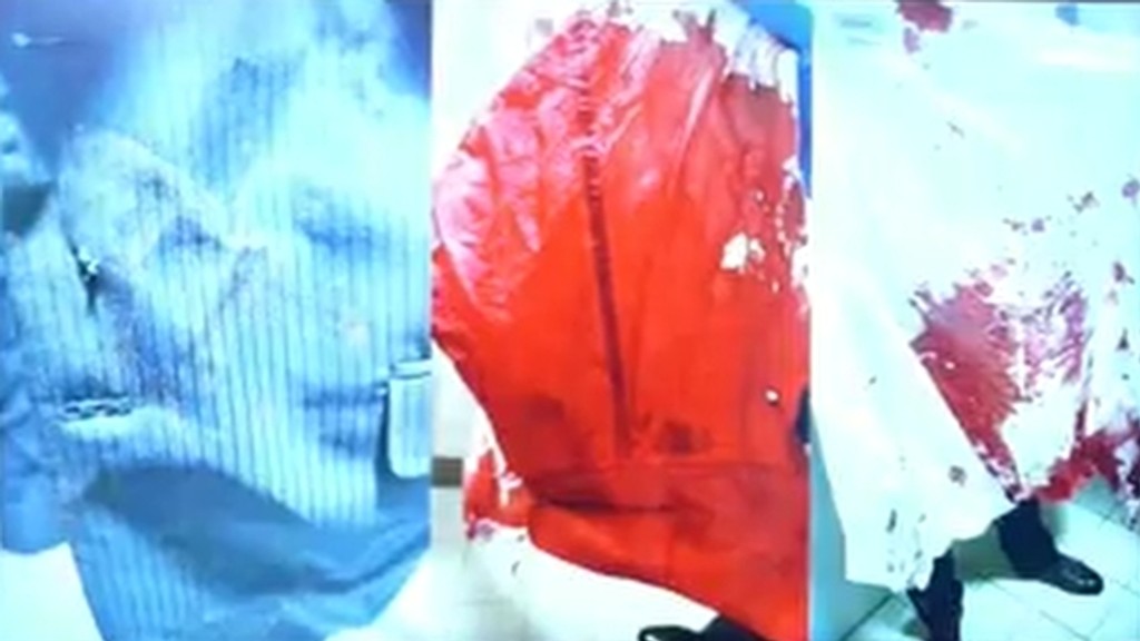 Zakrvavená košeľa. 