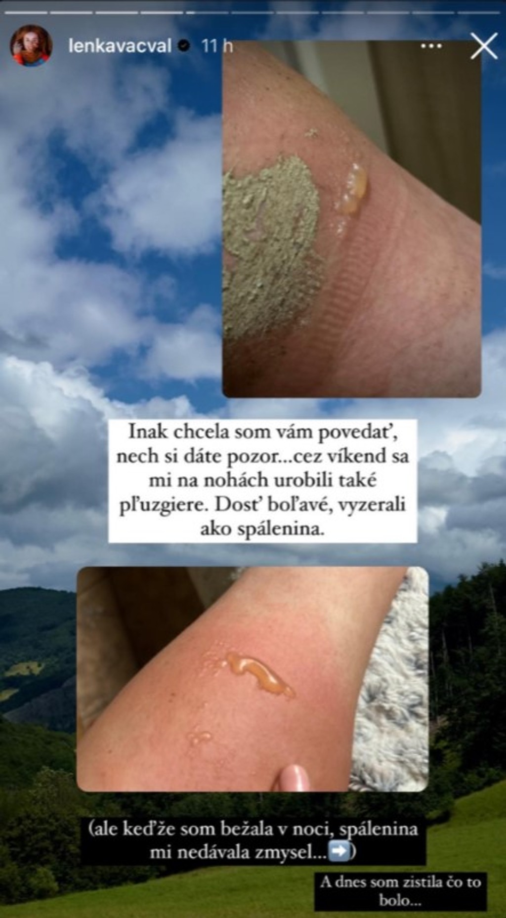 Príspevok herečky a horolezkyne Lenky Vacvalovej na sociálnej sieti. 