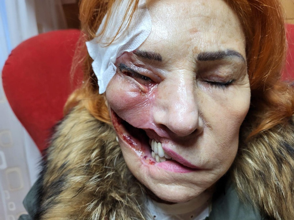 Parazit ničí Oľge tkanivo.