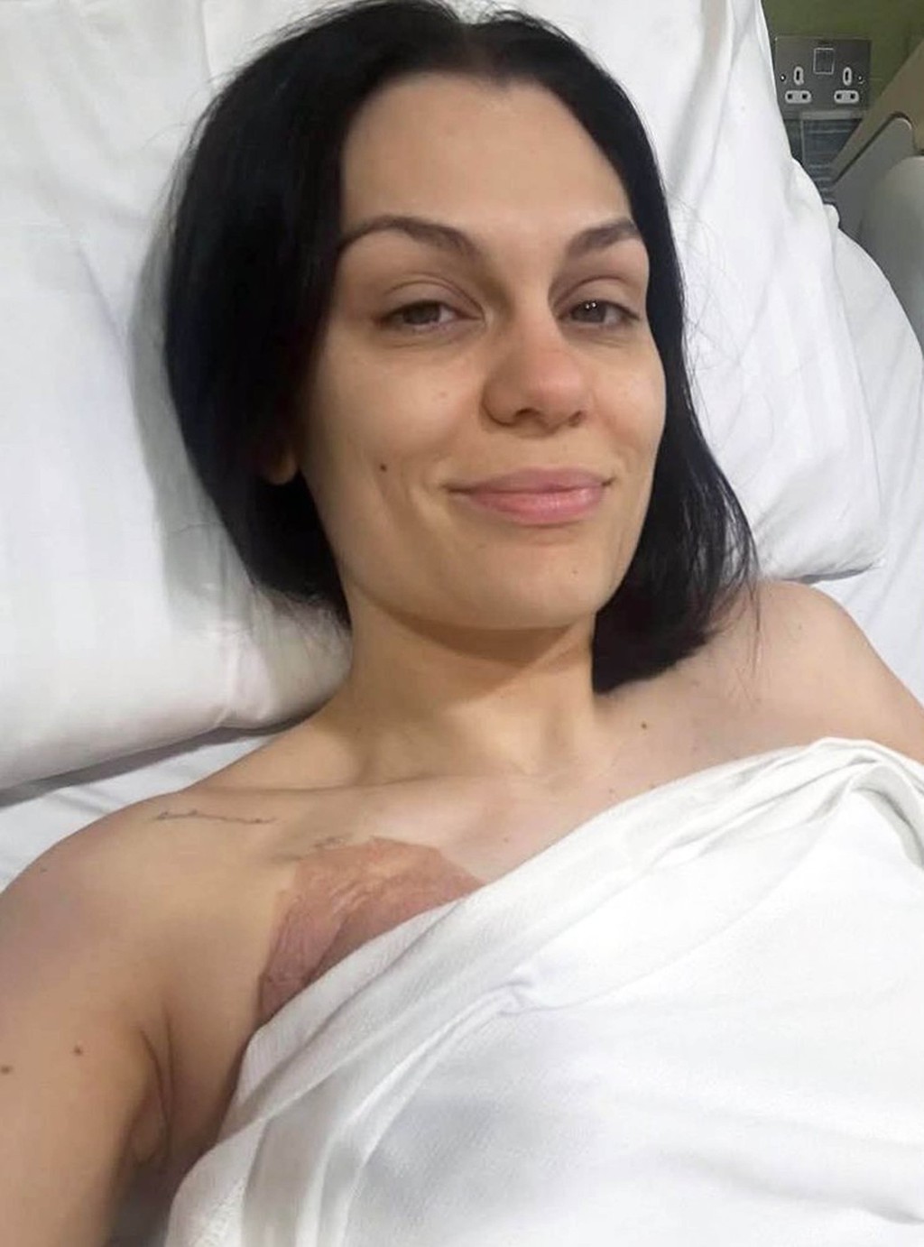 Jessie J museli hospitalizovať.