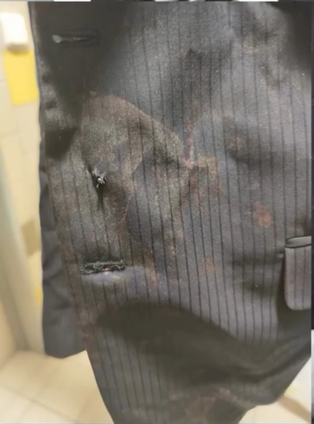 Prestrelené sako po atentáte.