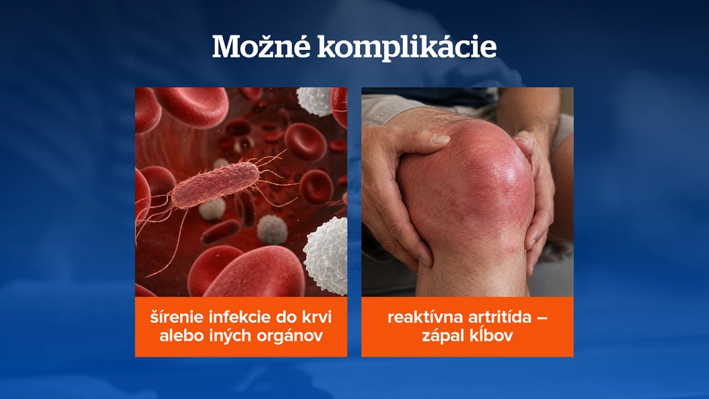 Možné komplikácie
