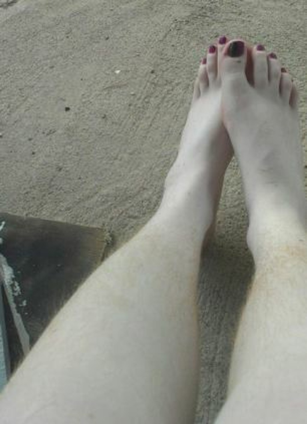 волосатые ноги и тело у женщин показать фото 106