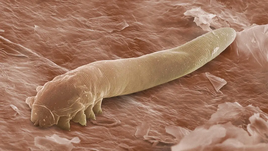 Mikroskopické roztoče Demodex