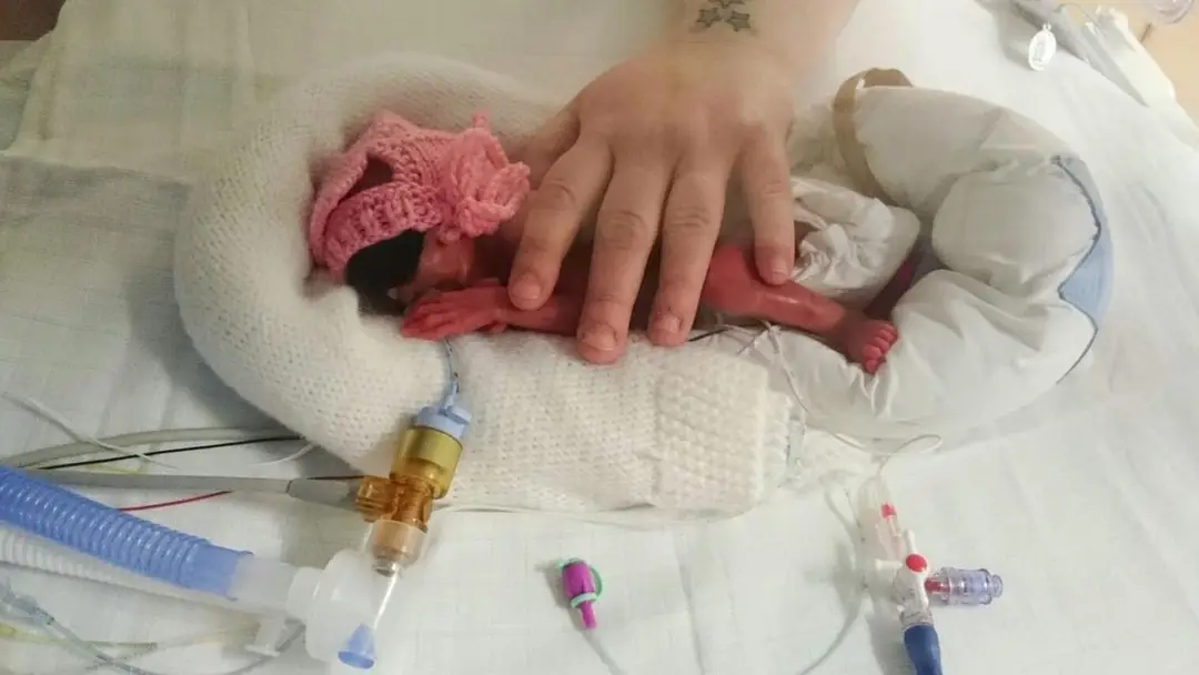 Francesca je podľa lekárov zázračné dieťa. 