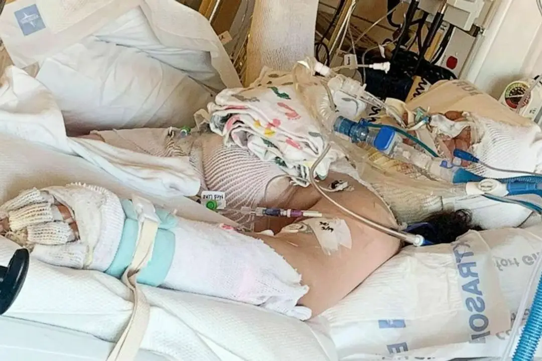 Destini Craneová skúšala nebezpečnú výzvu na internete