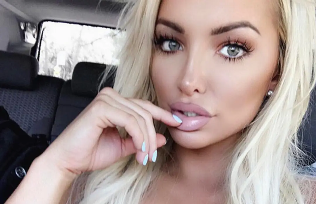 Trápenie tejto modelky pochopia len ženy s veľkými prsiami