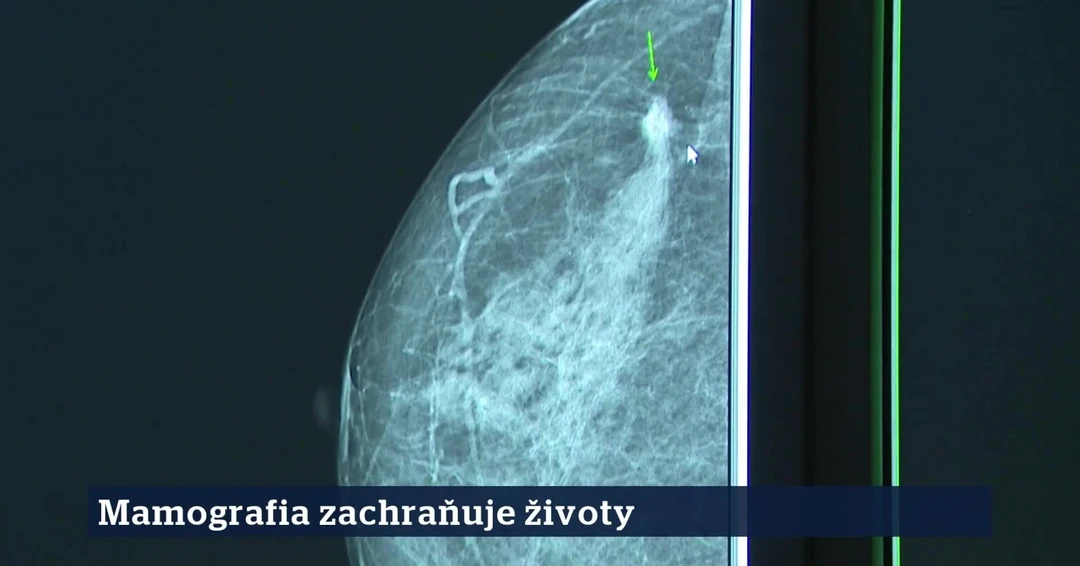 8. epizóda | 22. 9. 2026 | Miroslav Tomáš