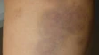 Policajná brutalita