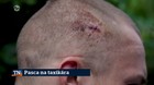 Pasca na taxikára