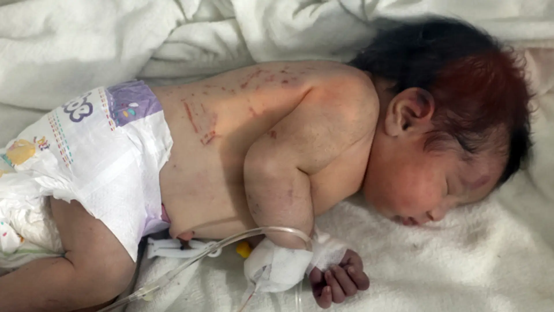 Dievčatko sa narodilo v troskách domu po zemetrasení v meste Džindíras v provincii Aleppo na severe Sýrie.