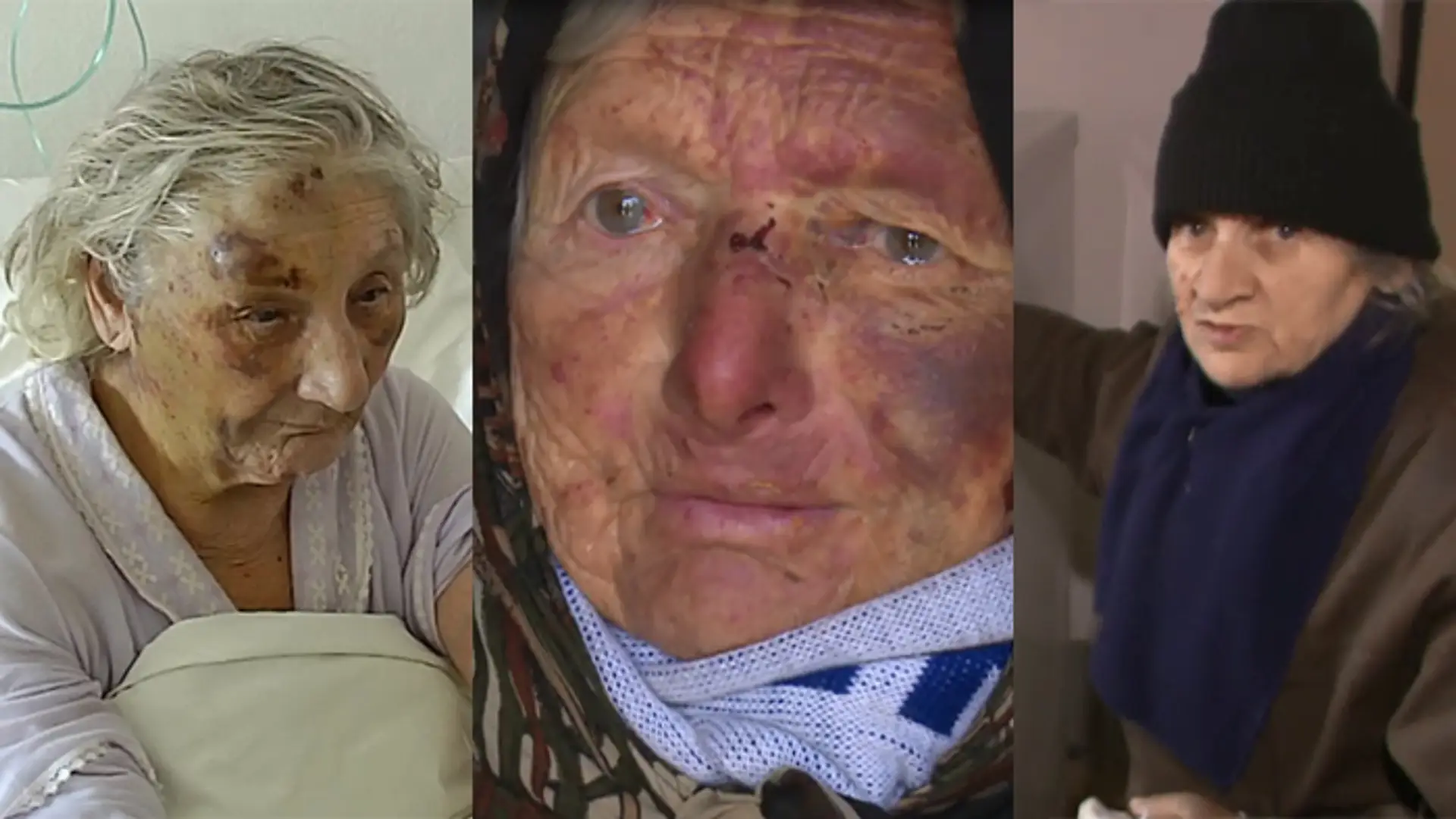 Za týždeň napadli tri dôchodkyne. Prečo šli páchatelia do väzenia až po medializácii?