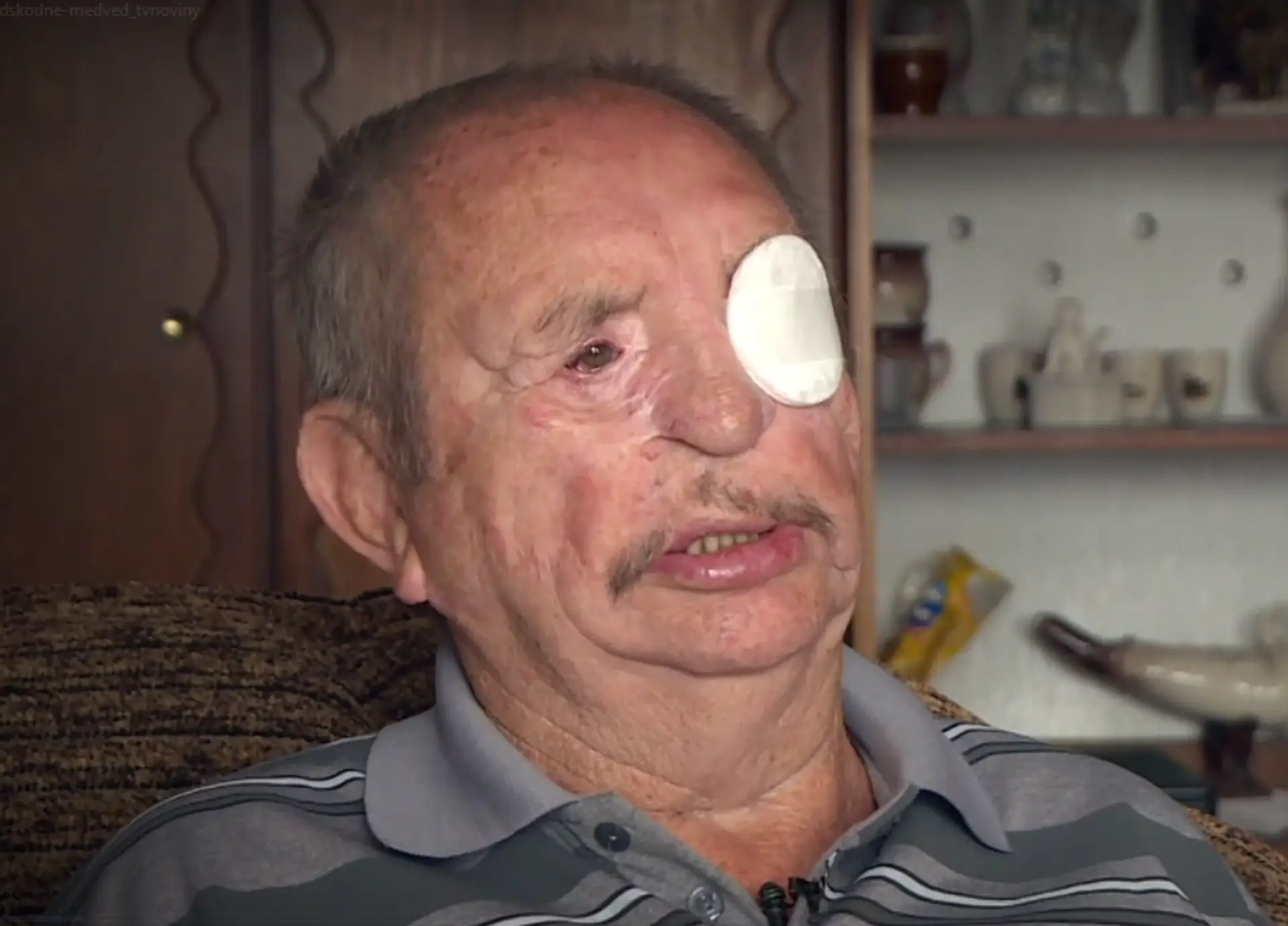 Jána Gejdoša z Liptovských Sliačov zmrzačil medveď