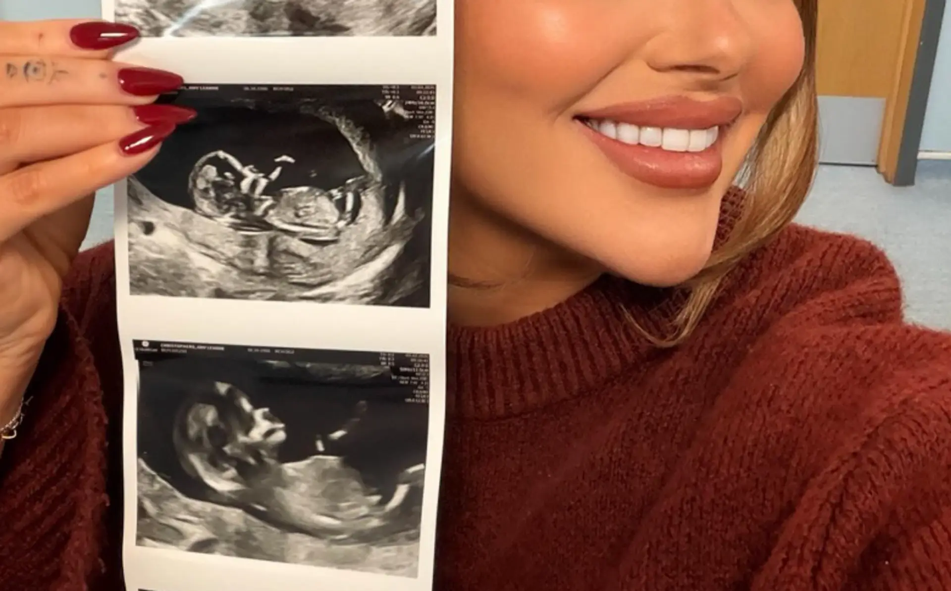 Amy Christophers z reality šou Svadba na prvý pohľad čaká bábätko