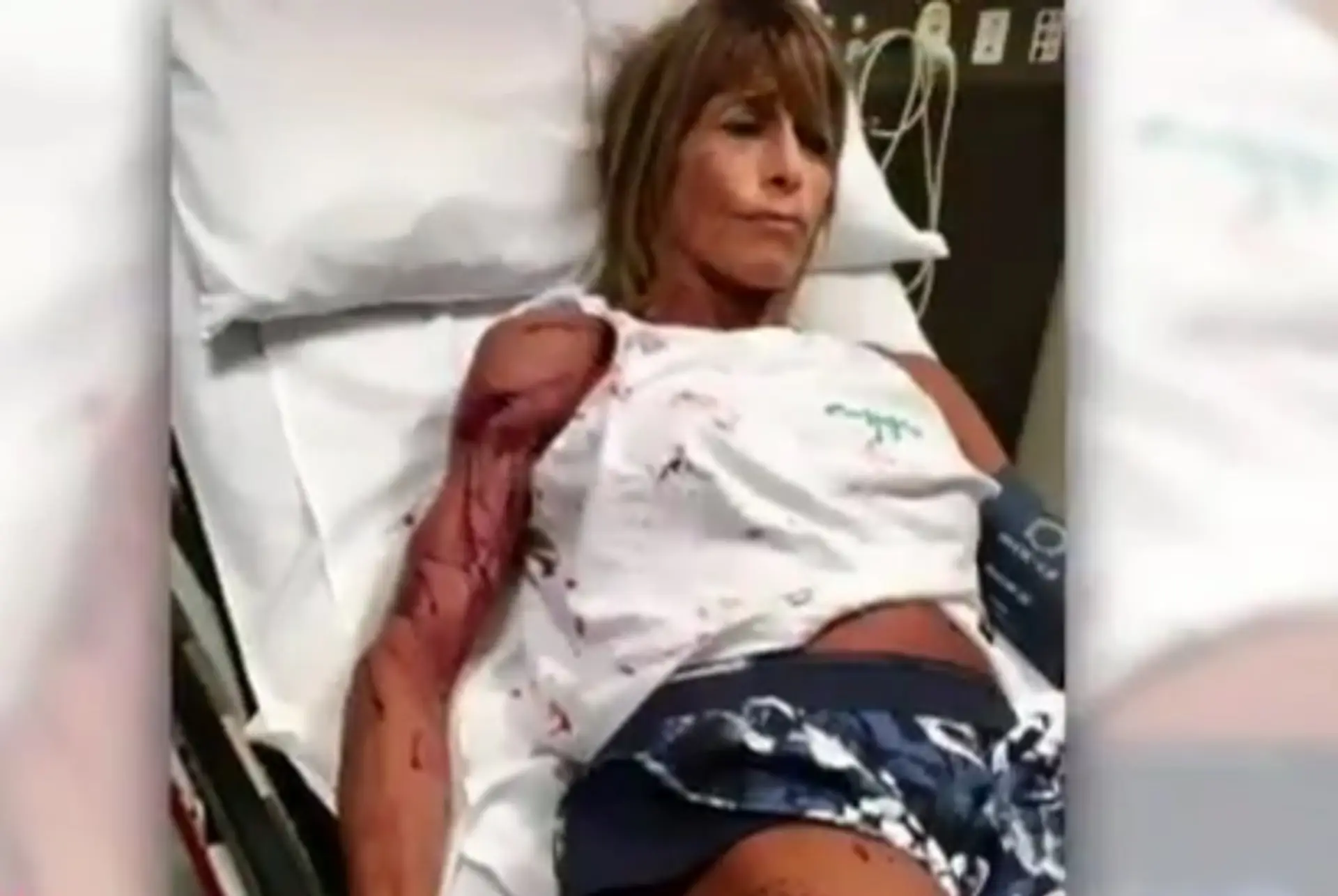 Austrálsku bežkyňu Debbie Urquhartovú napadla kengura.