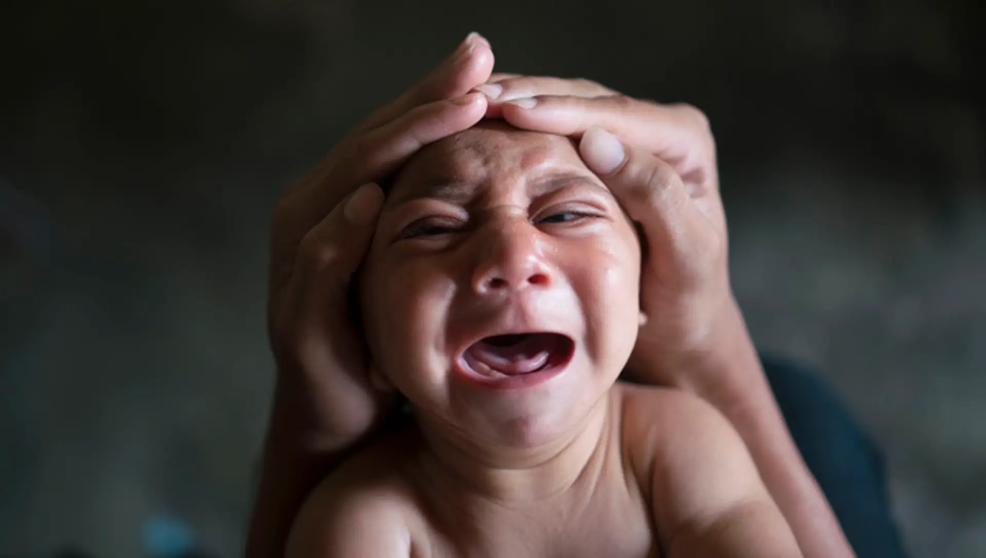 Viacerí odborníci sa domnievajú, že práve vírus zika je zodpovedný za nárast počtu novonarodených detí s abnormálne malými hlavi
