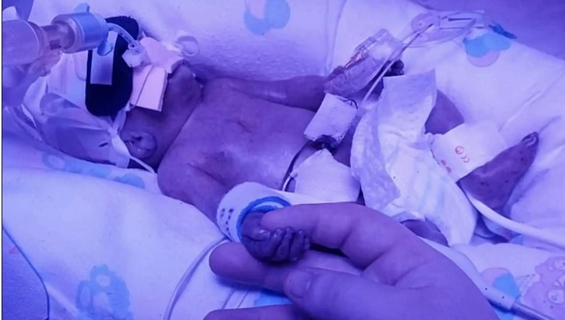 Pri stavbe bytovky sa zranili robotníci.