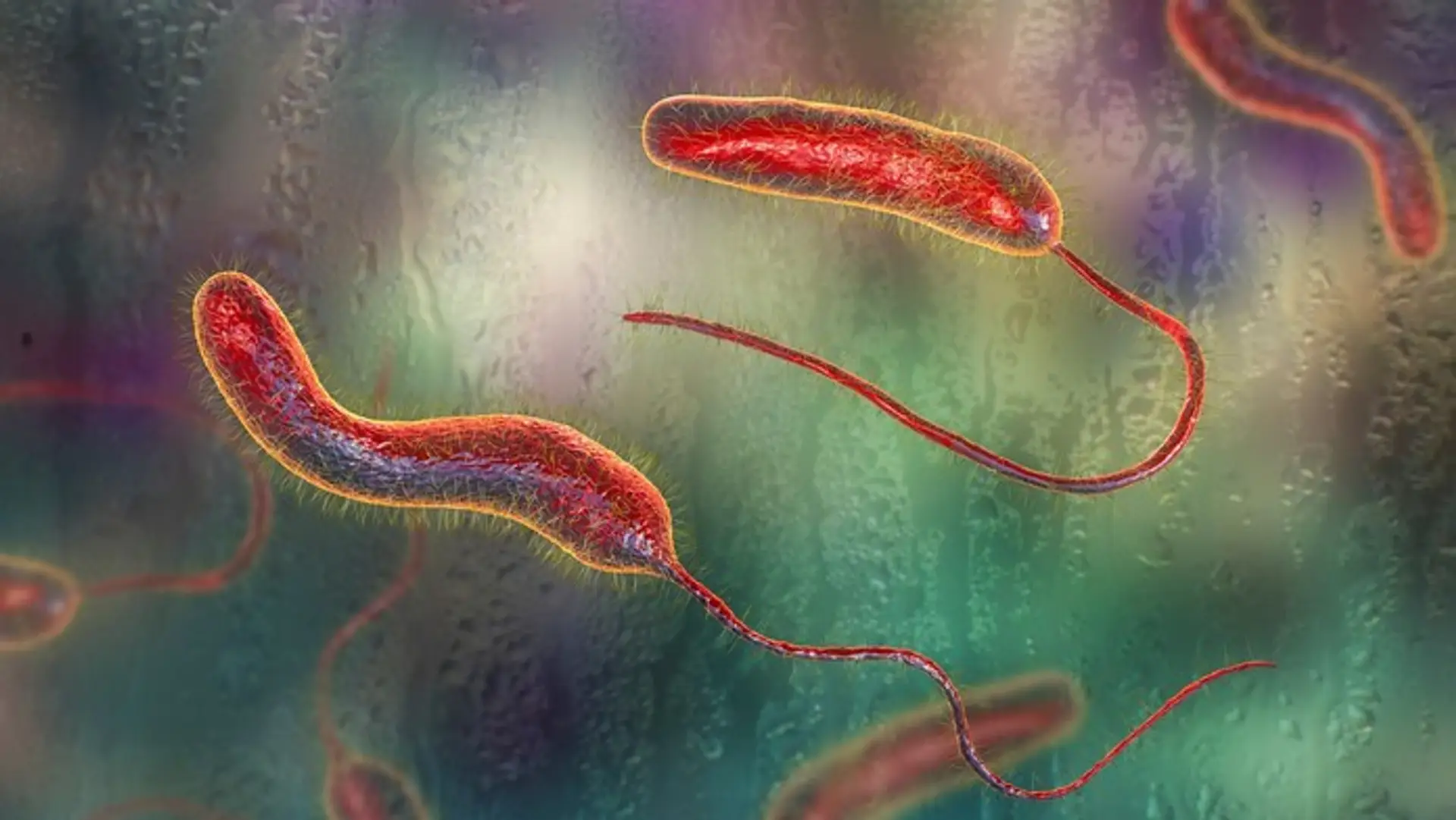 Baktérie cholery (Vibrio cholerae)