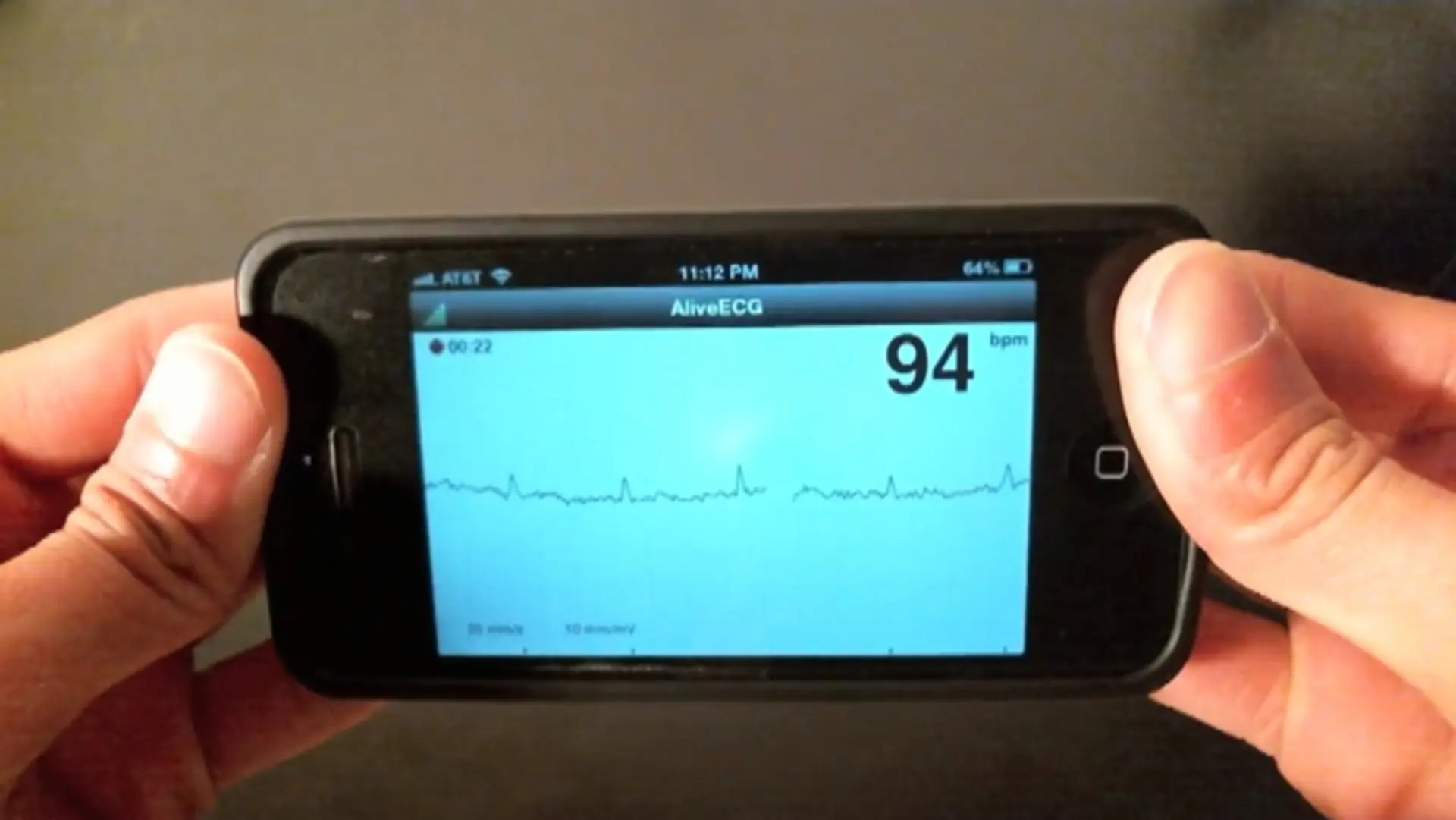 Smartfón ako EKG.