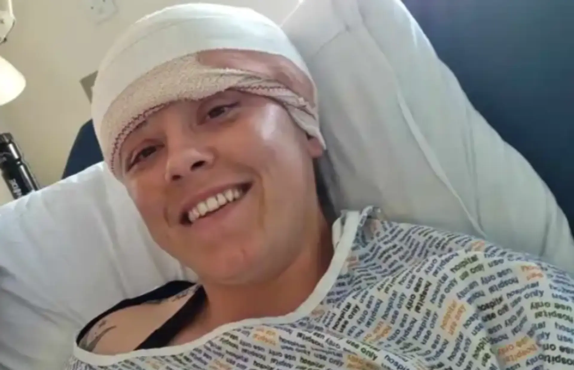 Jess počas liečby.