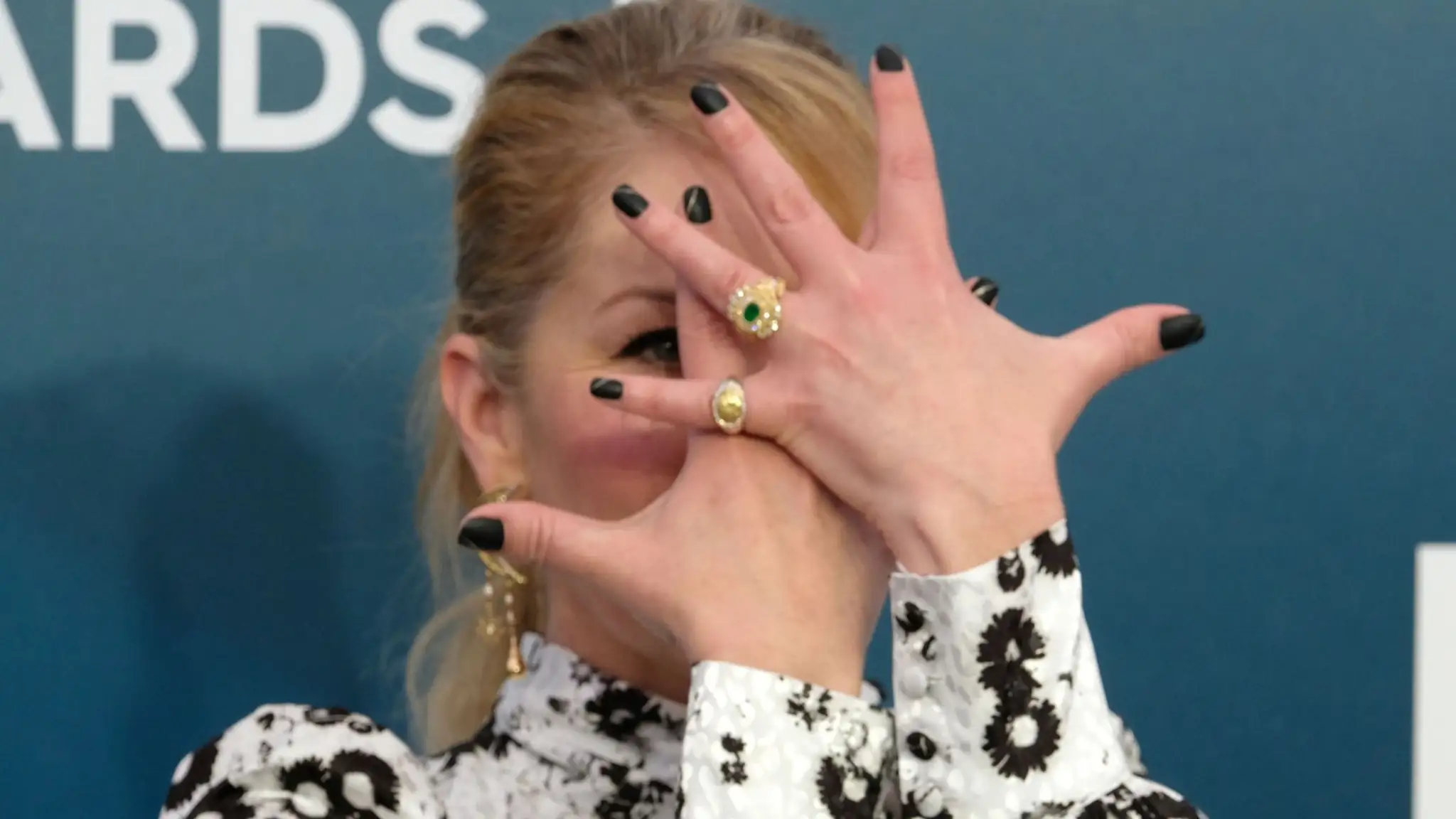 Christina Applegate prehovorila o zle diagnostikovanej skleróze multiplex