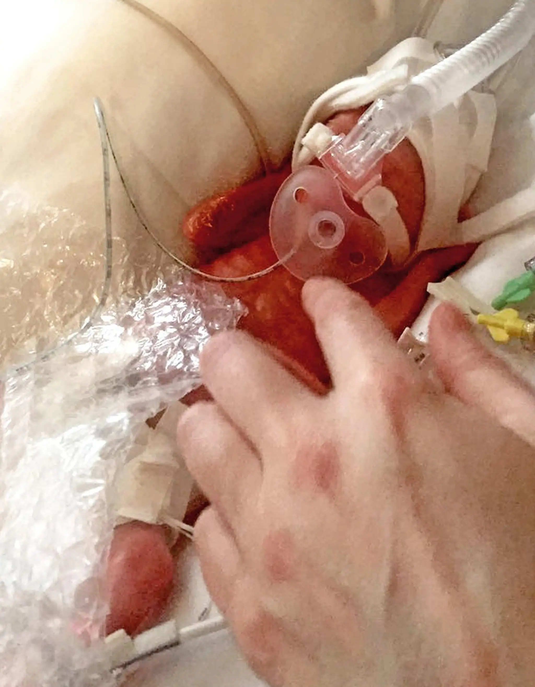 Malá Macey Micklethwaiteová sa po narodení zmestila matke do dlane.