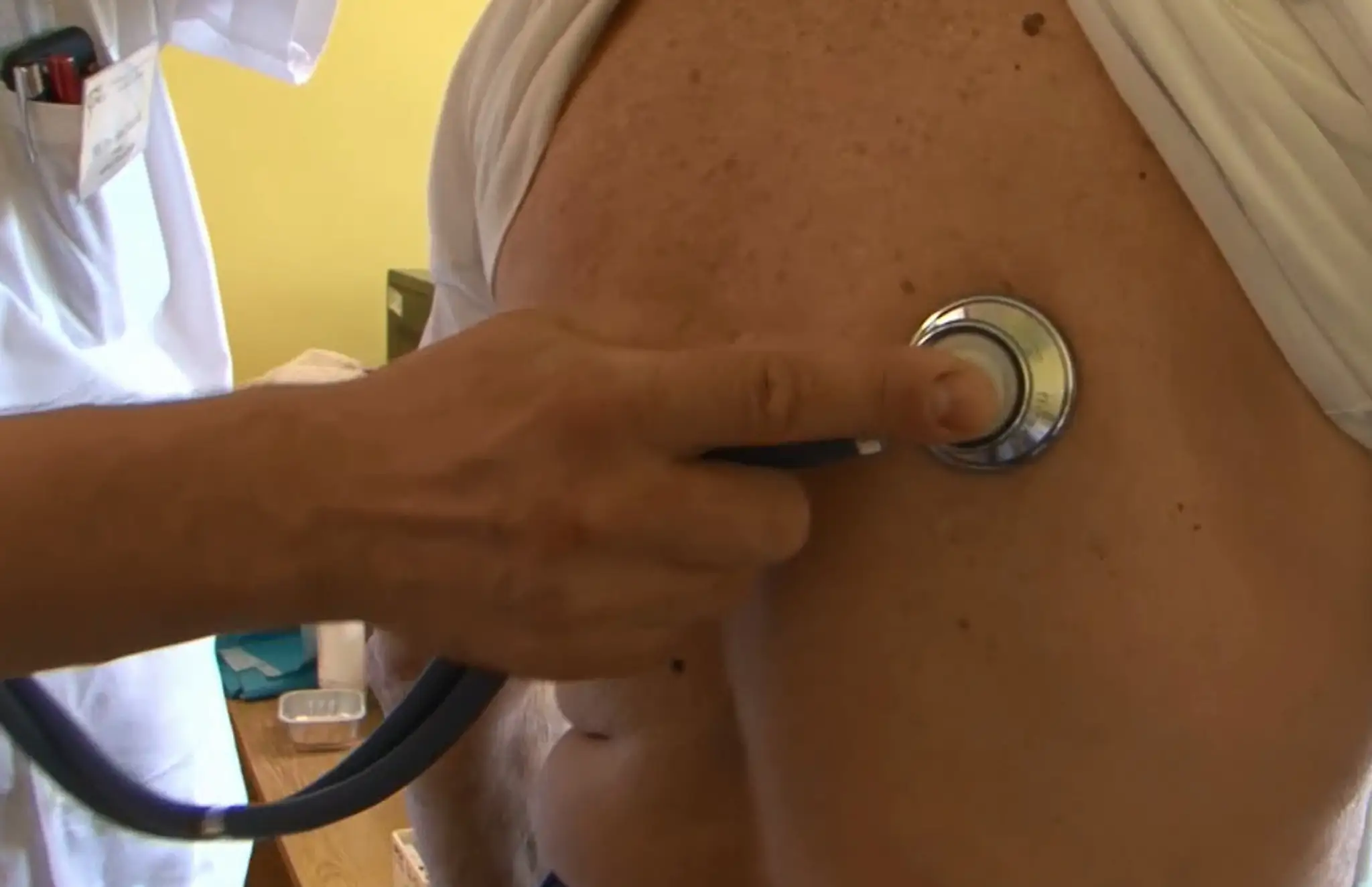 V Prievidzi bojujú s vysoko nákazlivou chorobou. Začala sa šíriť medzi bezdomovcami 