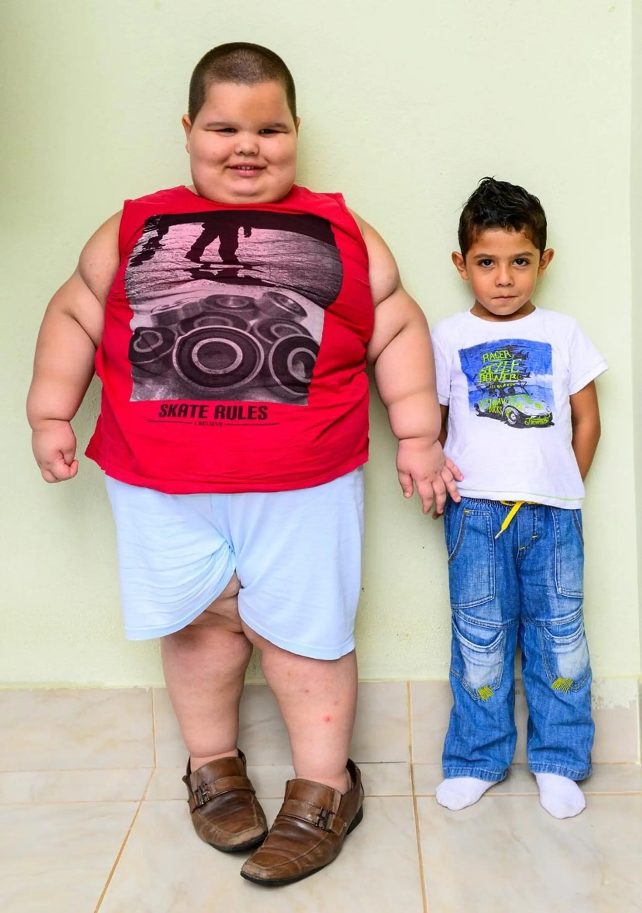Misael má päť rokov a váži 80kg.